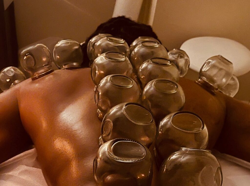 Fire Cupping Massage